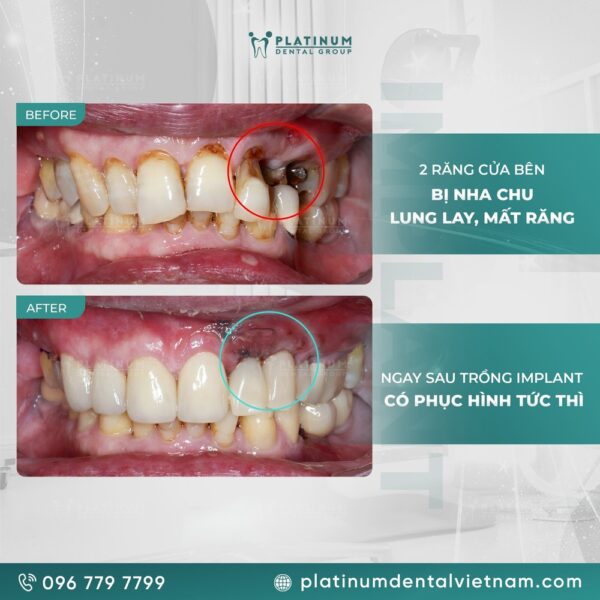 quà Tặng Cuộc Sống Hay Nhất: Phân Tích Chuyên Sâu Ứng Dụng Triết Lý Trong Đời Sống