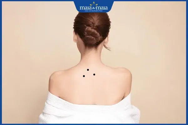 Ý nghĩa 3 nốt ruồi ở sau lưng phụ nữ xếp thành hình tam giác