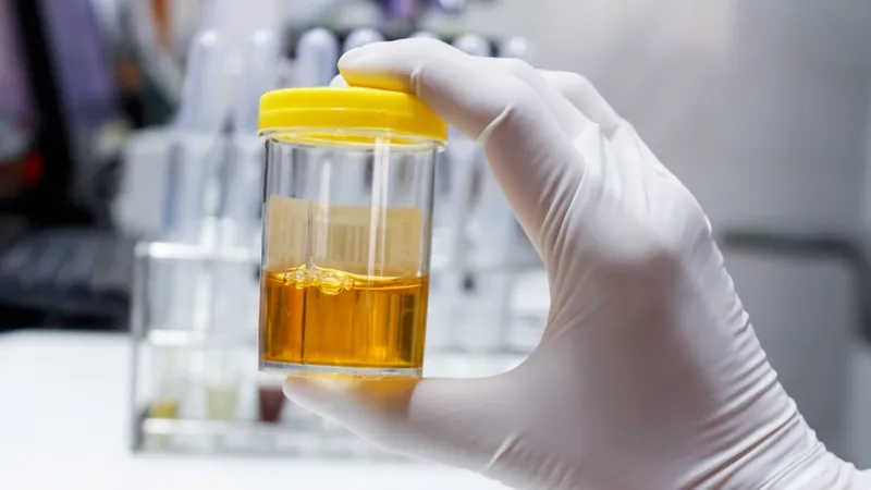 Xét nghiệm chỉ số glucose trong nước tiểu phụ nữ mang thai định kỳ