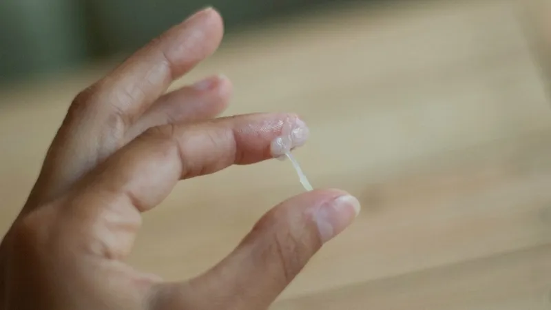 Khí hư bất thường là dấu hiệu điển hình của viêm phụ khoa