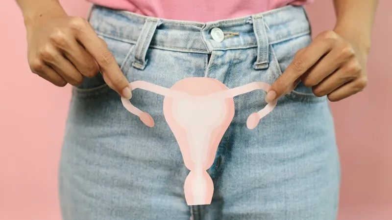 Viêm lộ tuyến cổ tử cung gây ra tình trạng khí hư ra nhiều, đôi khi có lẫn máu