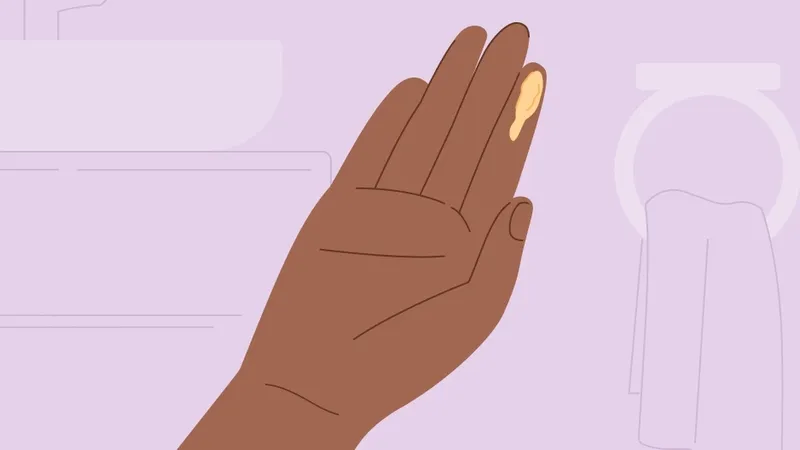 Viêm âm đạo do ký sinh trùng thường có khí hư màu vàng hoặc xanh