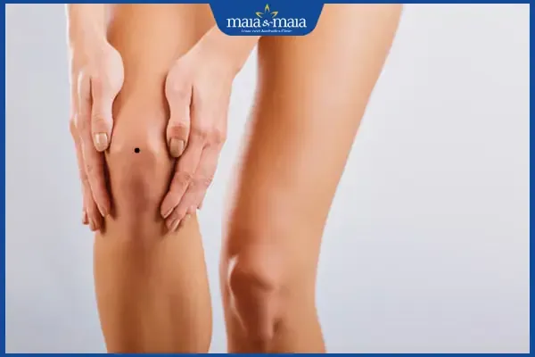 mọc nốt ruồi ở đầu gối