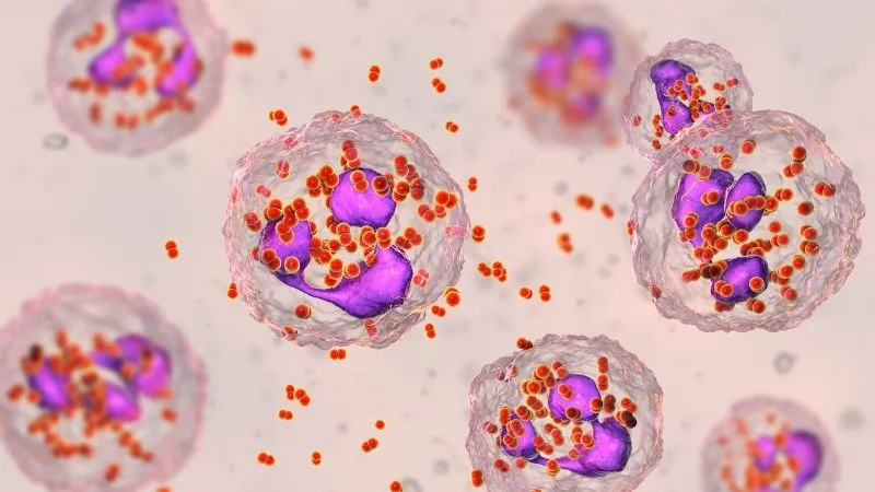 Viêm vùng chậu là một trong những nguyên nhân gây đau rát khi quan hệ