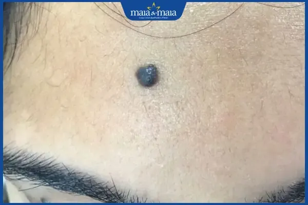 Vị trí nốt ruồi bên phải trán mang lại sự nghiệp ổn định cho phái đẹp