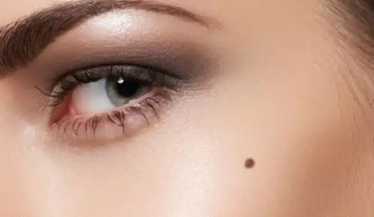 Vị trí nốt ruồi phú quý trên gò má phái đẹp