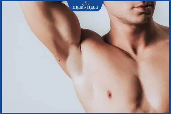 Nốt ruồi nách phải nam giới