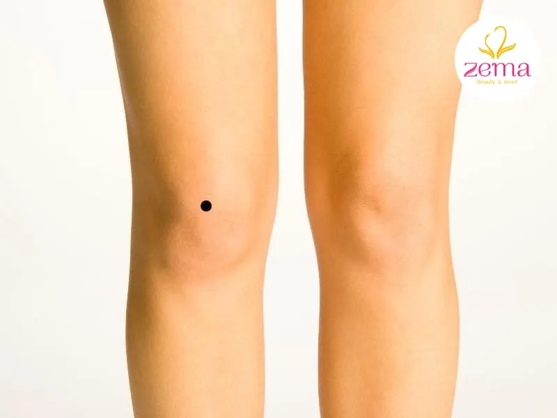 Người có nốt ruồi trên đầu gối thường gặp may mắn
