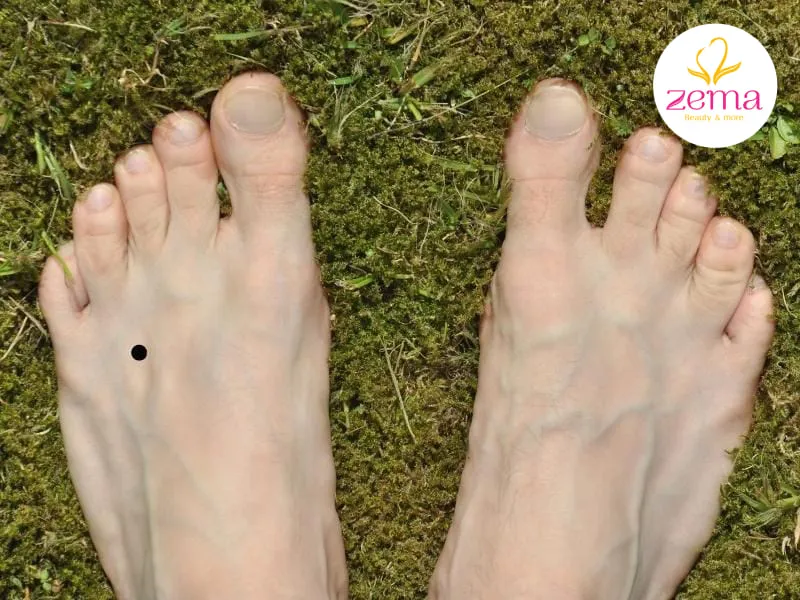 Nốt ruồi trên chân trái nhìn chung là nốt ruồi tốt