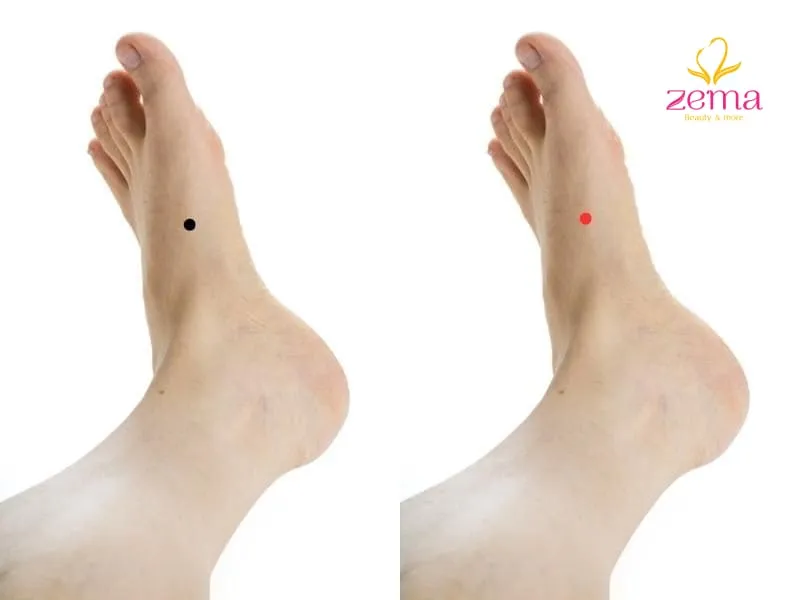 Trong nhân tướng học màu sắc của nốt ruồi cũng là một yếu tố quan trọng