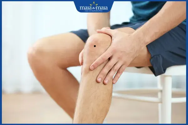 nốt ruồi ở đầu gối nam