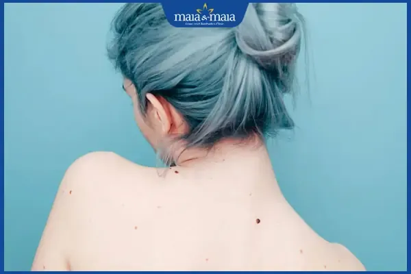 Phân tích nốt ruồi ở sau lưng phụ nữ theo nhân tướng học