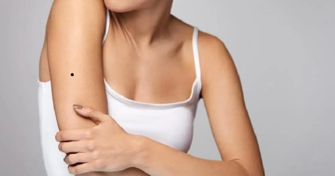 Ý nghĩa nốt ruồi ở bắp tay phụ nữ về tài lãnh đạo.