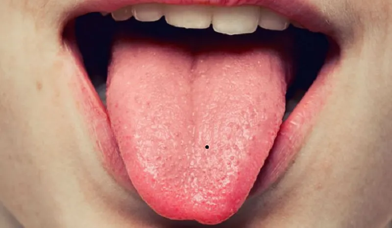 Xem bói nốt ruồi trên lưỡi phụ nữ về khả năng giao tiếp.