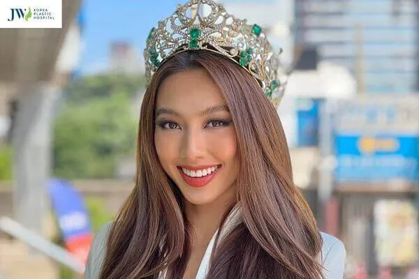 Phụ nữ trán cao rộng