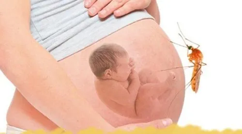 Người phụ nữ mang thai bị sốt xuất huyết cần được theo dõi y tế liên tục để đảm bảo an toàn cho cả mẹ và thai nhi